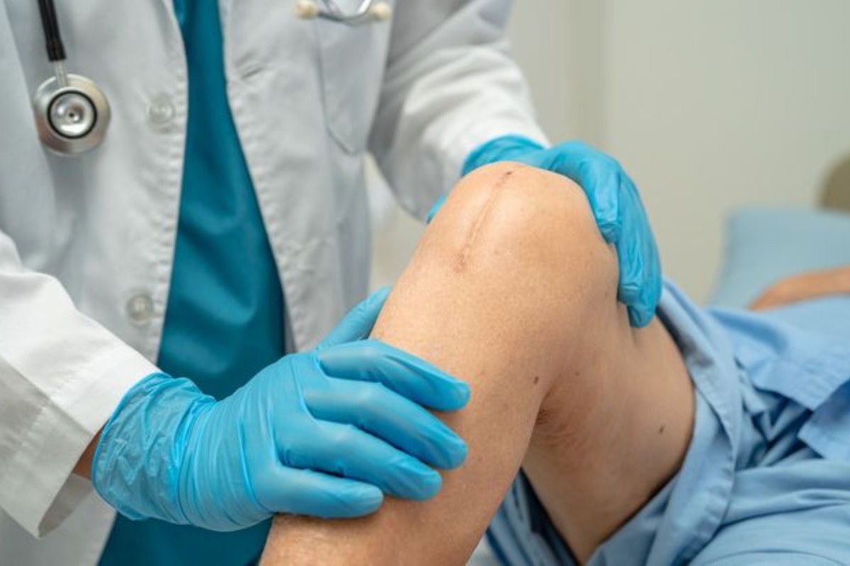 Knee Surgery