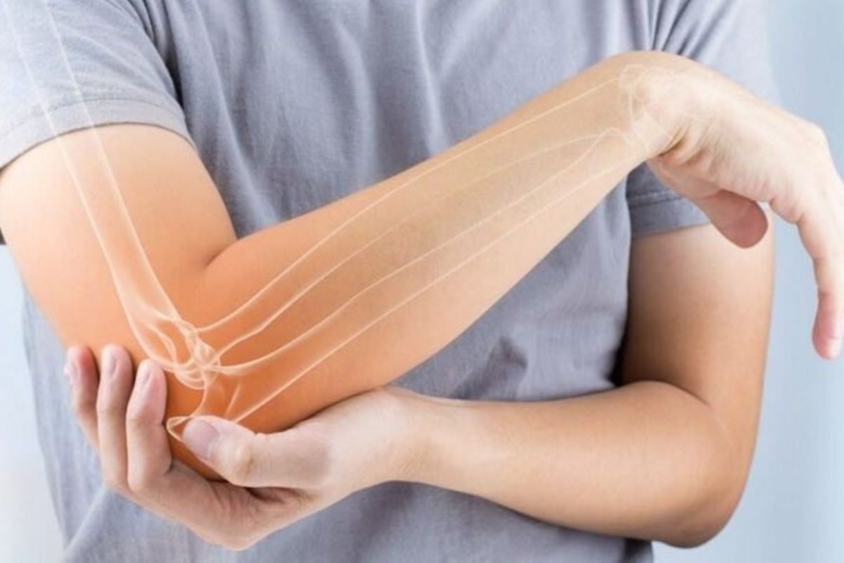 Elbow Surgery