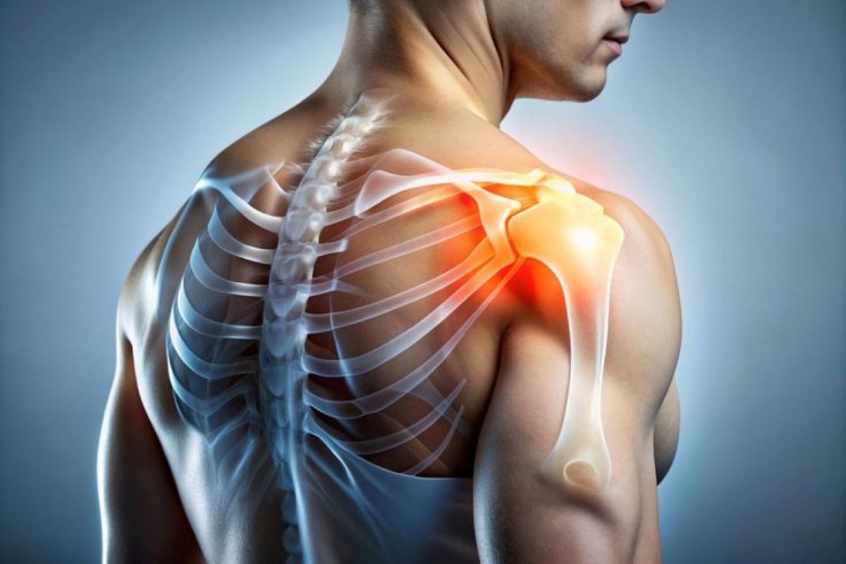 Shoulder Surgery