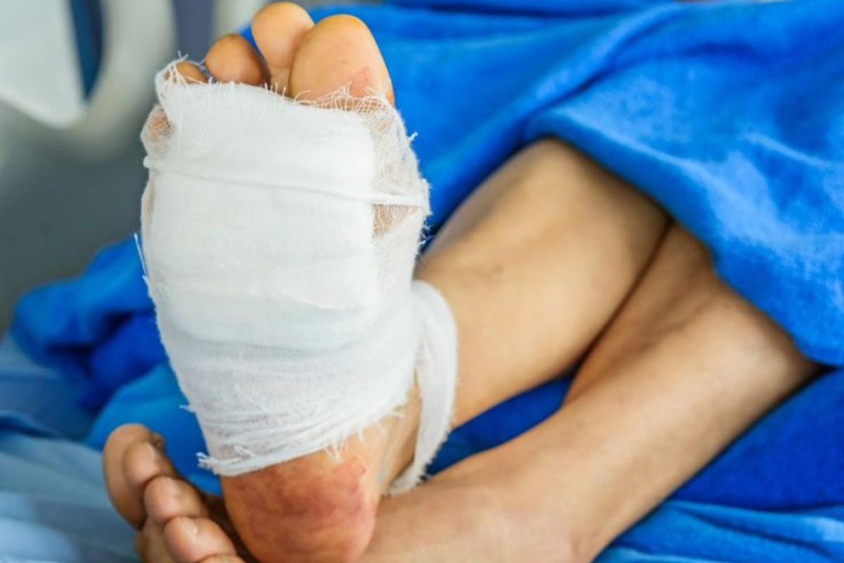 Foot and Ankle Surgery