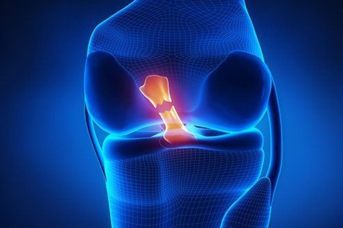 ligament Tear Injury