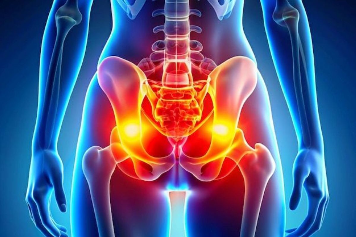 Pelvis Acetabular Surgery